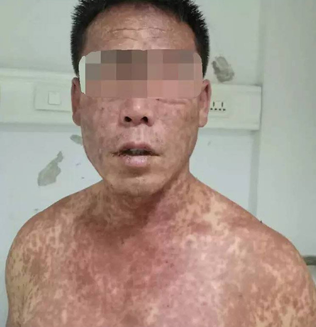 兴发娱乐·xf187(中国集团)官方网站